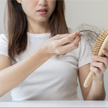  Treating Hair Loss in Kochi  