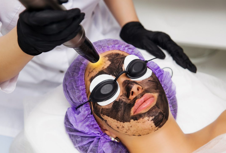 Dermatologist performing carbon peel treatment at Skinpal Clinic Kochi